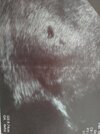 20220713_065723.jpg
