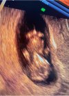 IMG_9989.jpeg