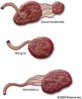 types-of-placenta-e1288690581219.jpg