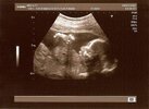 scan0001 -1.jpg