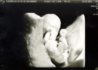 baby.jpg