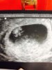 ImageUploadedByForum BabyBoom1390324431.461442.jpg