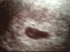 ImageUploadedByForum BabyBoom1394200157.418225.jpg