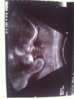 ImageUploadedByForum BabyBoom1416660046.106463.jpg ImageUploadedByForum BabyBoom1416660046.106463.jpg