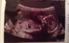 ImageUploadedByForum BabyBoom1417165640.932740.jpg ImageUploadedByForum BabyBoom1417165640.932740.jpg