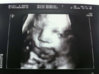 ImageUploadedByForum BabyBoom1419728264.318982.jpg