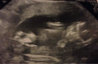 ImageUploadedByForum BabyBoom1427826560.157872.jpg