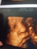 ImageUploadedByForum BabyBoom1428317043.158083.jpg
