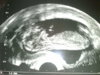 200905041862.jpg