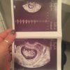 ImageUploadedByForum BabyBoom1449590739.001511.jpg