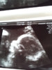 ImageUploadedByForum BabyBoom1450969796.869225.jpg