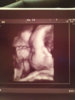 ImageUploadedByForum BabyBoom1452777852.825217.jpg