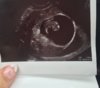 ImageUploadedByForum BabyBoom1458911009.732456.jpg