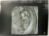 ImageUploadedByForum BabyBoom1461359090.736124.jpg
