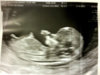 ImageUploadedByForum BabyBoom1461359103.054124.jpg