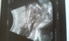 20160608_114802.jpg