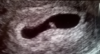 upload_2016-7-3_21-25-38.png