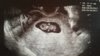 1470326941605.jpg