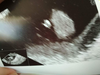 C48DA74D-8505-4D49-95BE-BB70BD8D12BC.png
