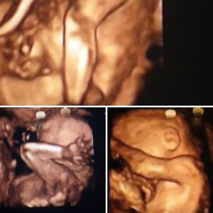 Nasz syn 22 tc skarb najdrozszy