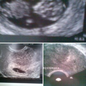 moje Małe Wielkie Szczęście...