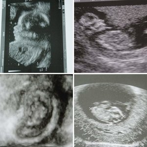 Nasze drugie  szczęście :-) MILENKA :-))))))