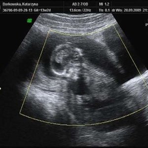 Moje szczęście - 13 tydzień